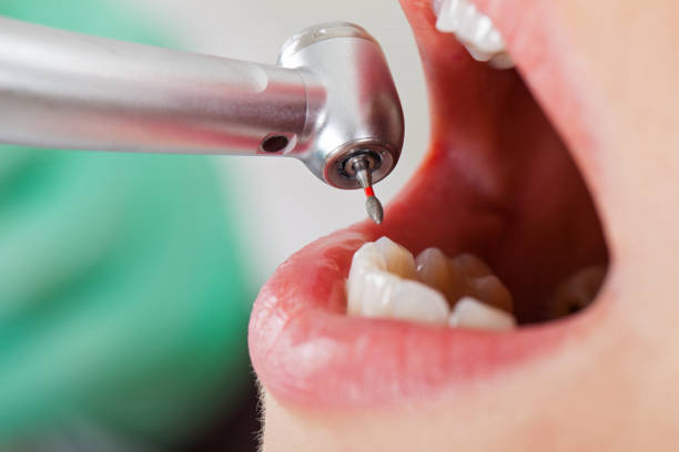 Best Emergency Denture Repair in Shelburne Falls, MA